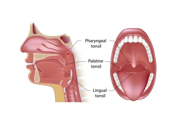 Adenoid Tonsil Surgery