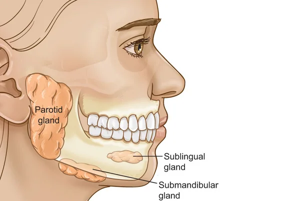 Parotid Surgery