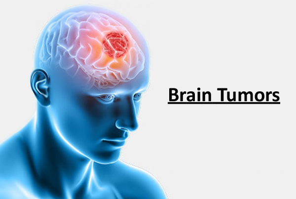 Brain Tumor