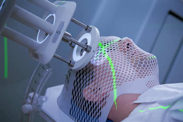 Stereotactic Brain Surgery
